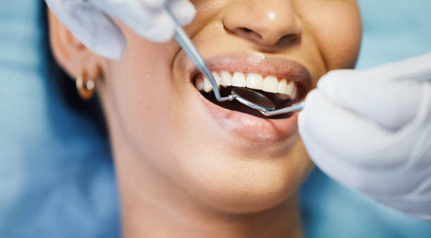 Best Emergency Root Canal Treatment in Robinwood, MD